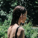 Ce sunt arsurile solare si cum le previi