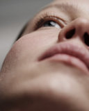 Femeie adultă cu imperfecțiuni în zona bărbiei și produsul Ivapur K