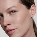 Ingrediente care contribuie la estomparea petelor pigmentare