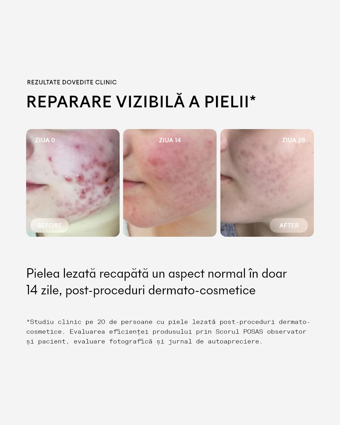Cicaderm Spray reparator cu Mimosa tenuiflora pentru leziuni umede și piele sensibilă, 50 ml