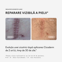 Cicaderm Cremă Reparatoare cu Mimosa Tenuiflora