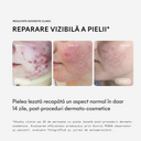Cicaderm Spray reparator cu Mimosa tenuiflora pentru leziuni umede și piele sensibilă, 50 ml