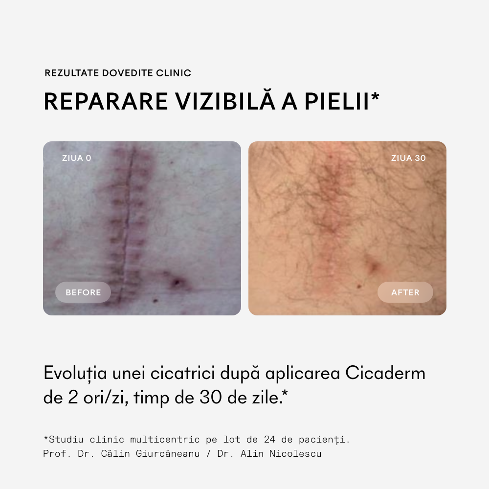 Studiu in vivo pe 24 de pacienți pentru Ivatherm Cicaderm Cremă Reparatoare