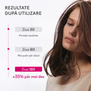 Rezultate clinice la 6 luni cu Ivatherm ivaHAIR Strong Hair Serum, studiu TrichoScan
