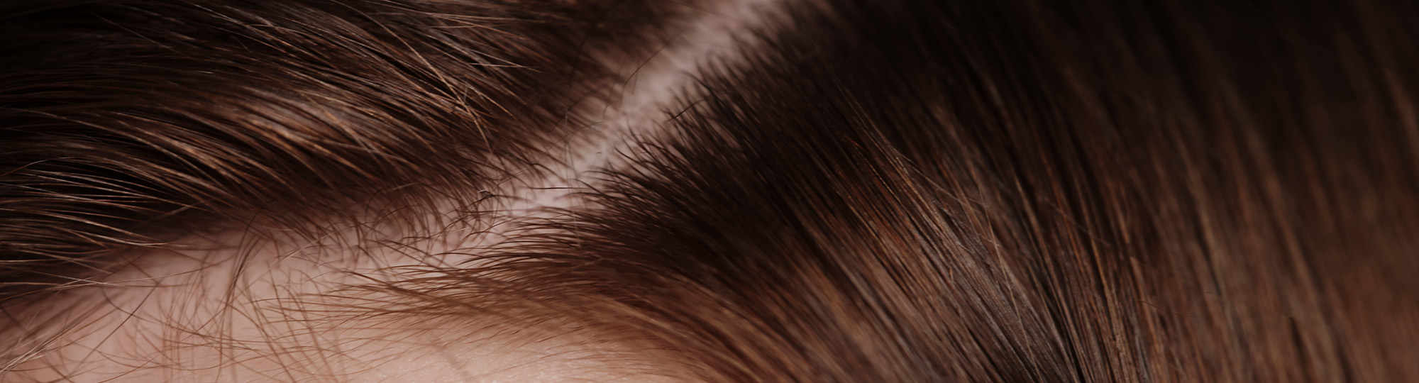 Microbiota scalpului: rol și beneficii pentru sănătatea capilară