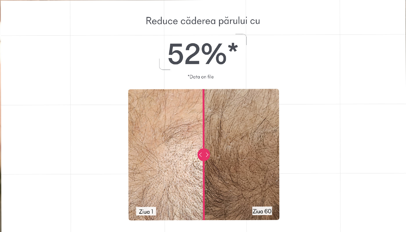 Reduce caderea pariului