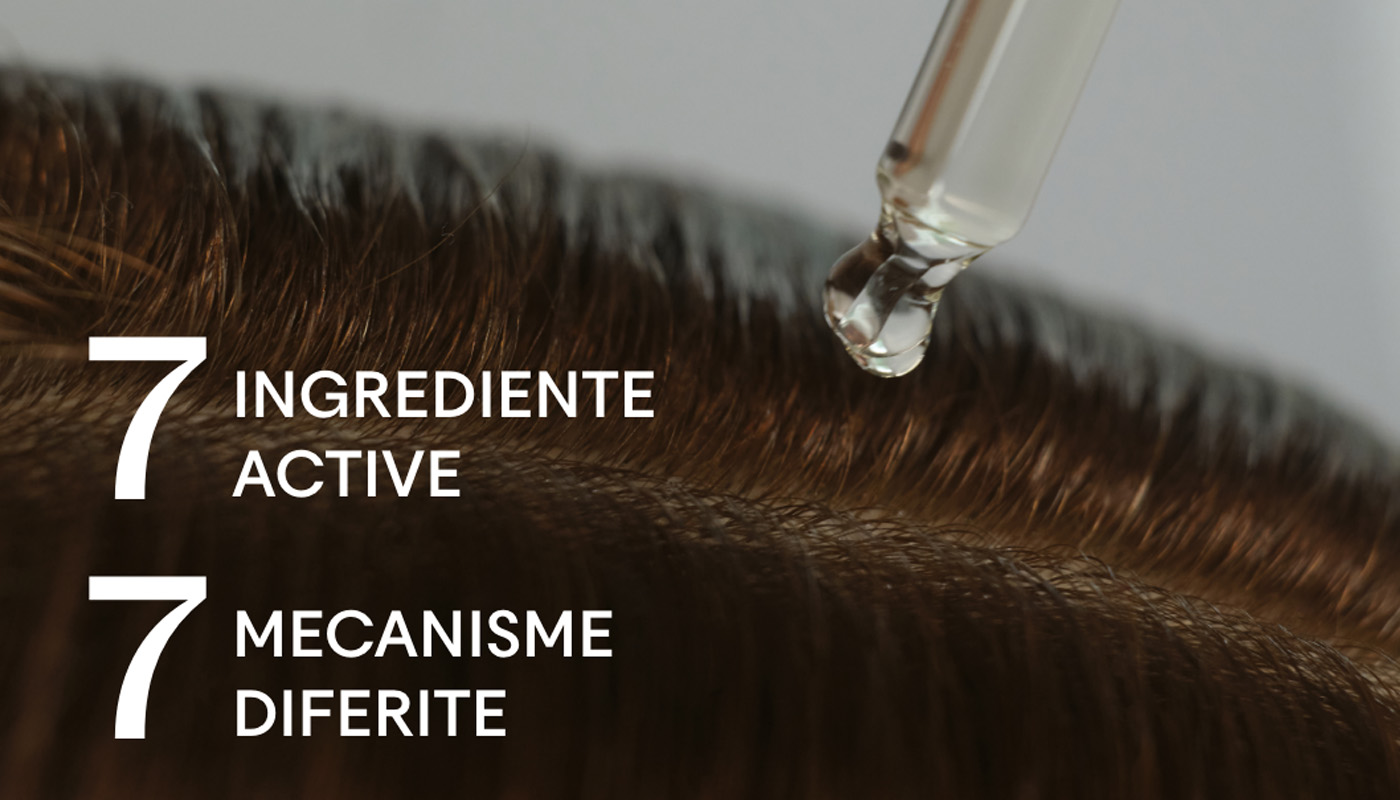 ce este alopecia